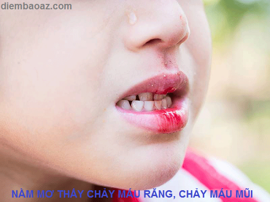 chay mau chan rang la benh gi 1